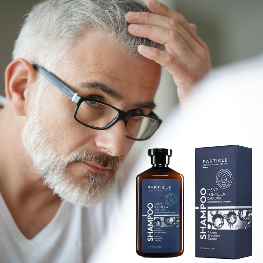 Male Hair Loss