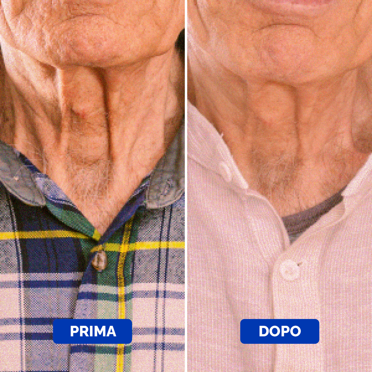 Neck Cream Before & After 2 Italian