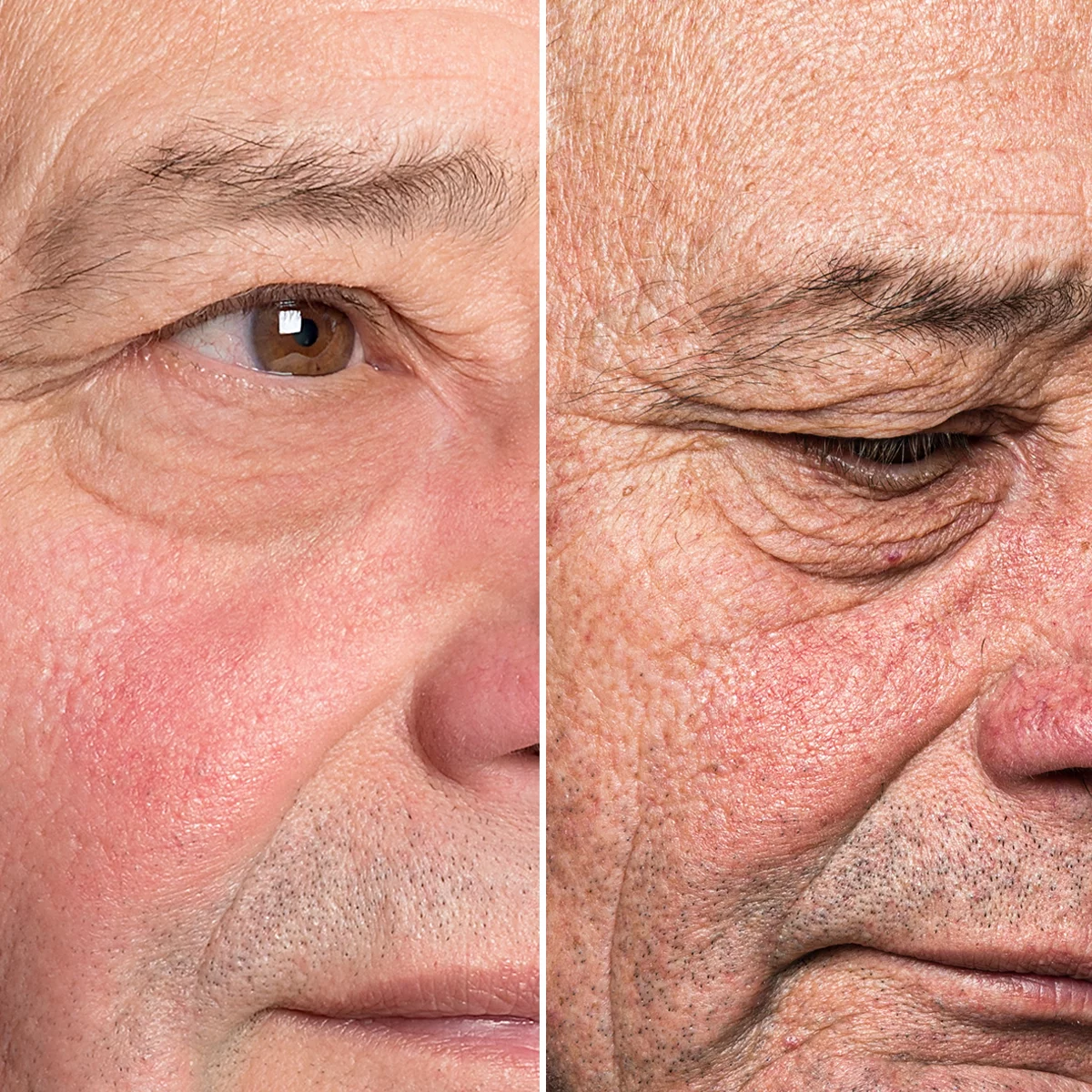 Particle Face Cream Before & After 2 Flipped