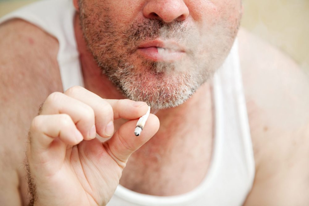 Smoking blocks and poluts your facial skin pores