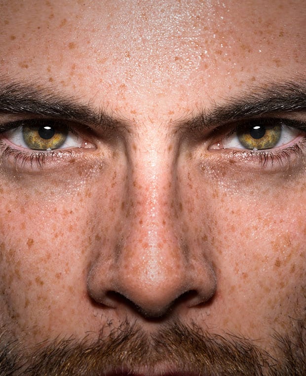 7 Ways to Treat the Skin Around Your Eyes