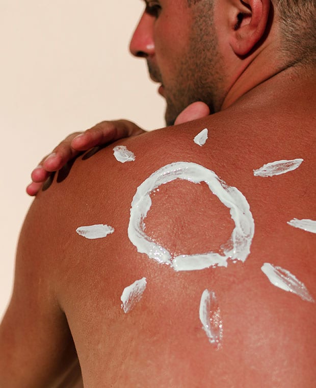 How to Prevent Scarring After a Burn?