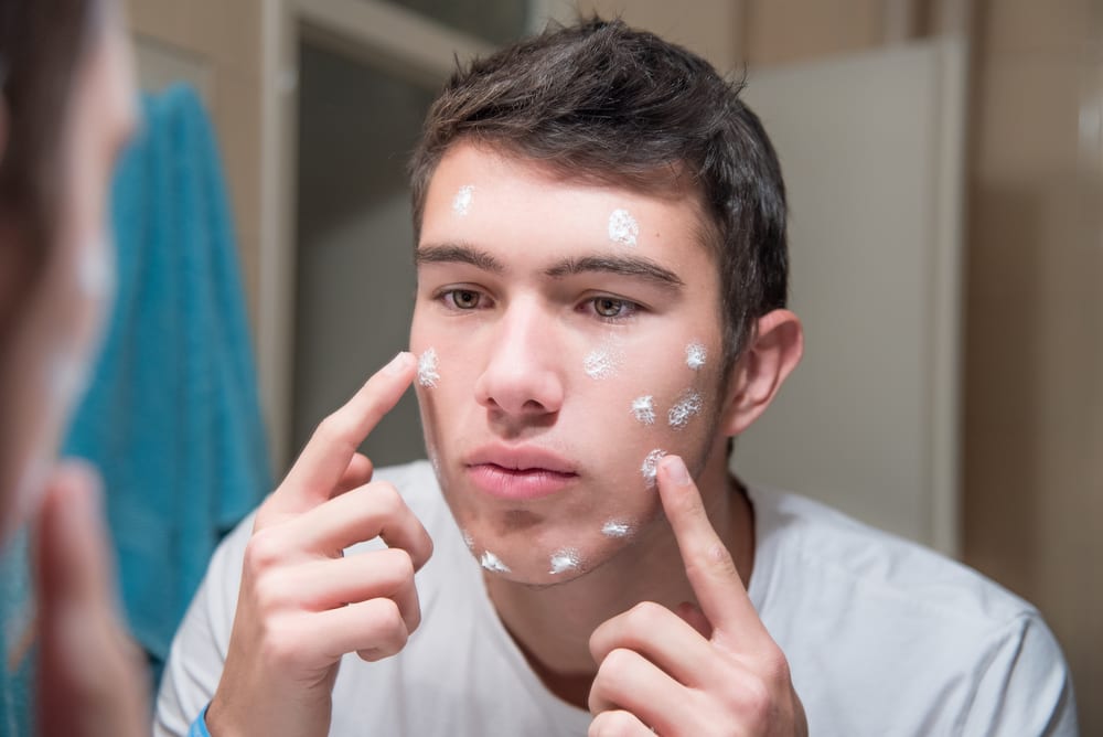 Skindcare and acne