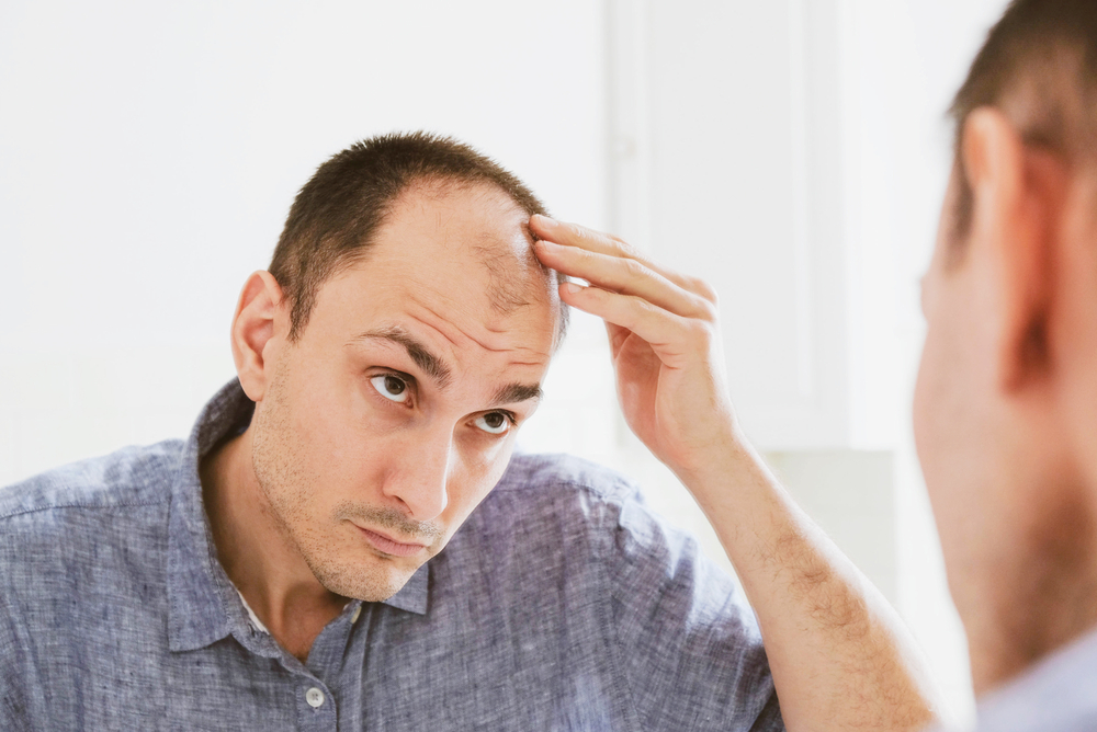 Why do men lose hair? What are some of the causes that increase hair thinning?