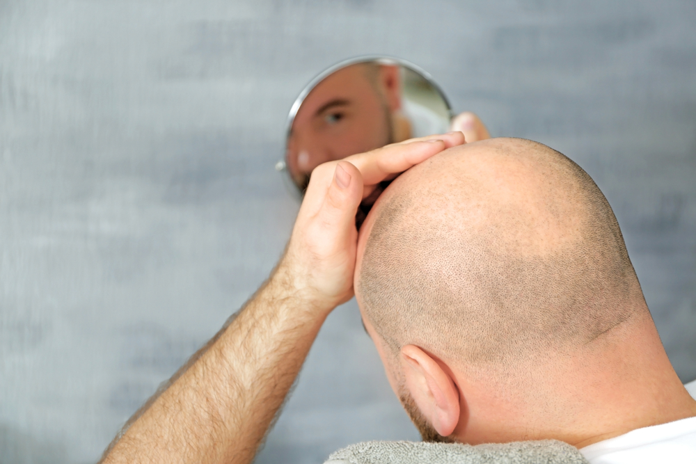 Never ever shave your head without having a mirror close by