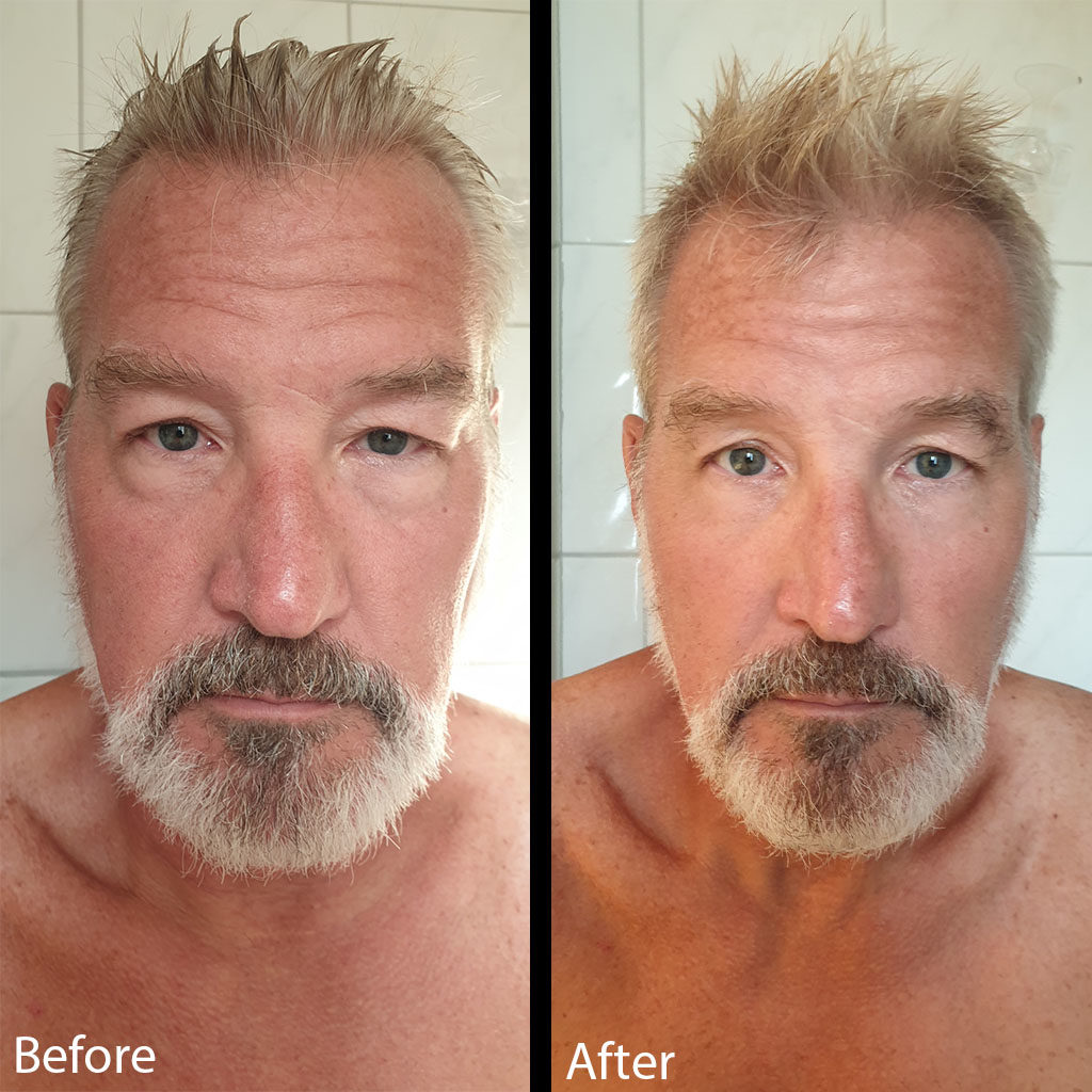 jeremy lea before and after photos using particle for men