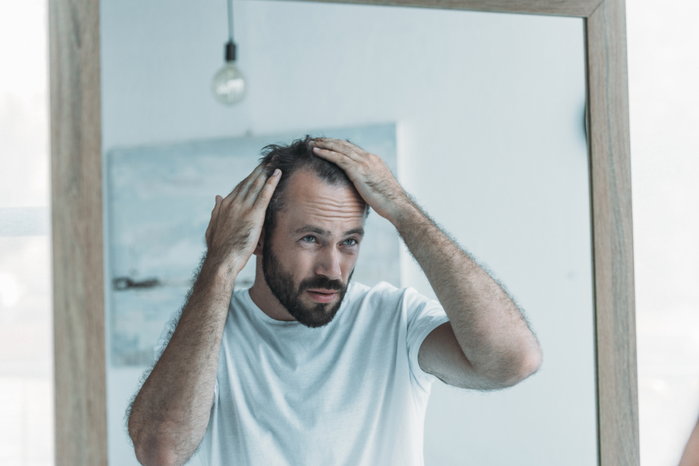 Aging has many “side effects”, one of them being natural hair loss