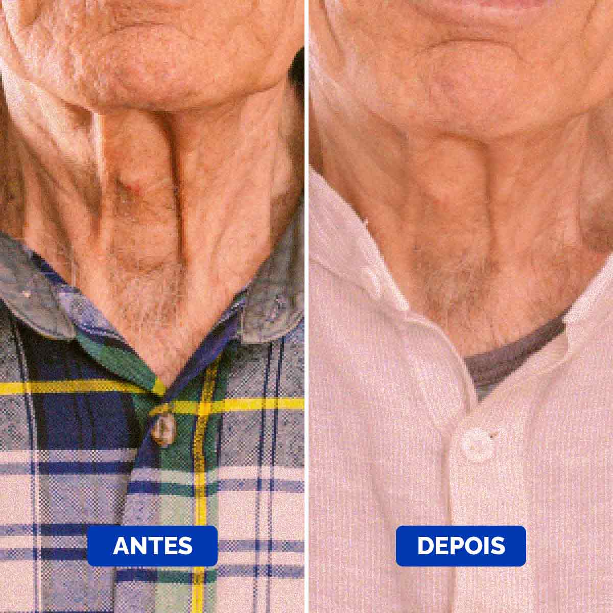 Neck-Cream-Before-&-After-2_1200x1200_Portuguese_Compressed