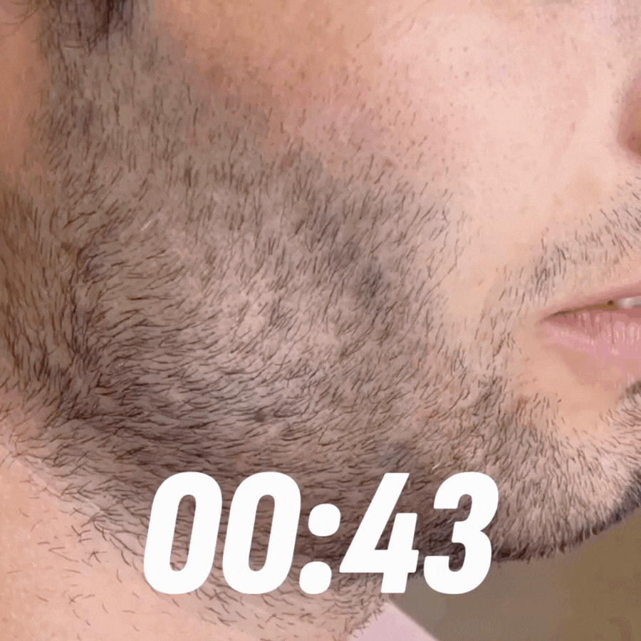 43-Second Oxygen Activation Technology