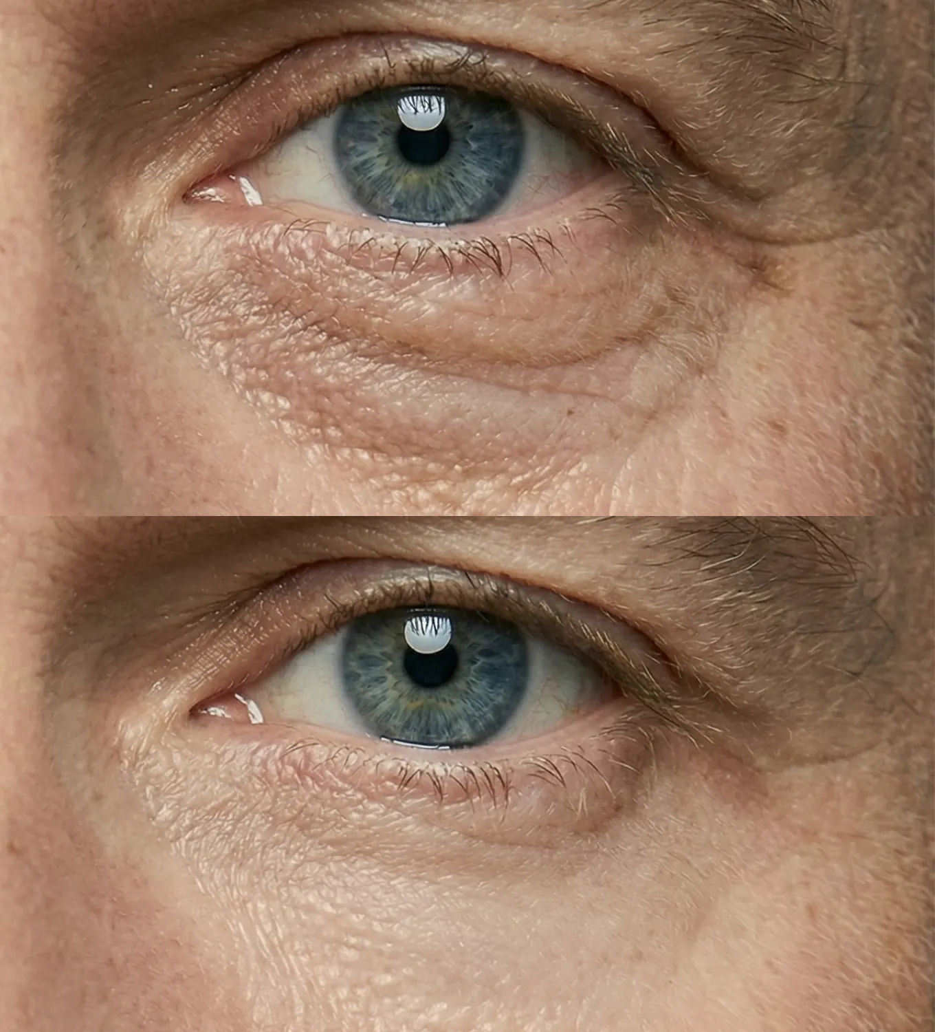 Instant Eye Firming Cream _ Website _ Gallery images _ B&A1 1080x1350 _ V3