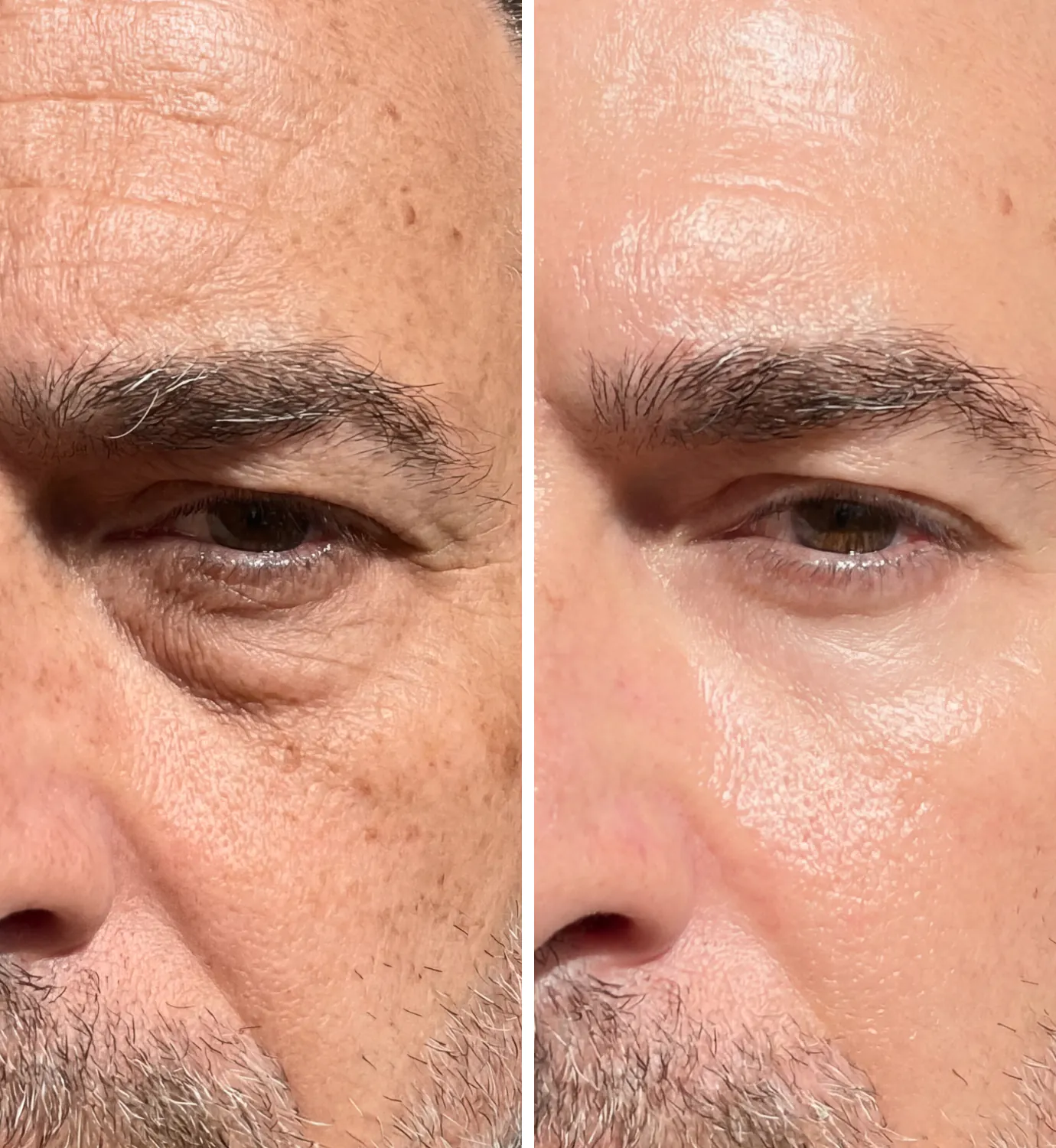 Head Turner _ Website _ Gallery images _ 1080x1350 V8