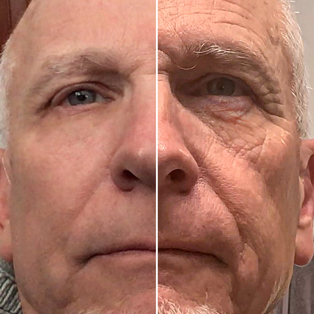 Before and After - Dan