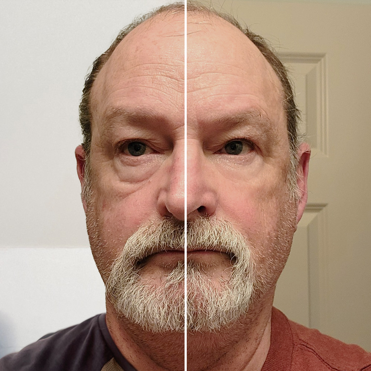 Before and After - William