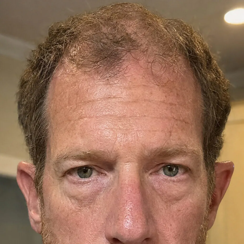 Fuller Looking Hair